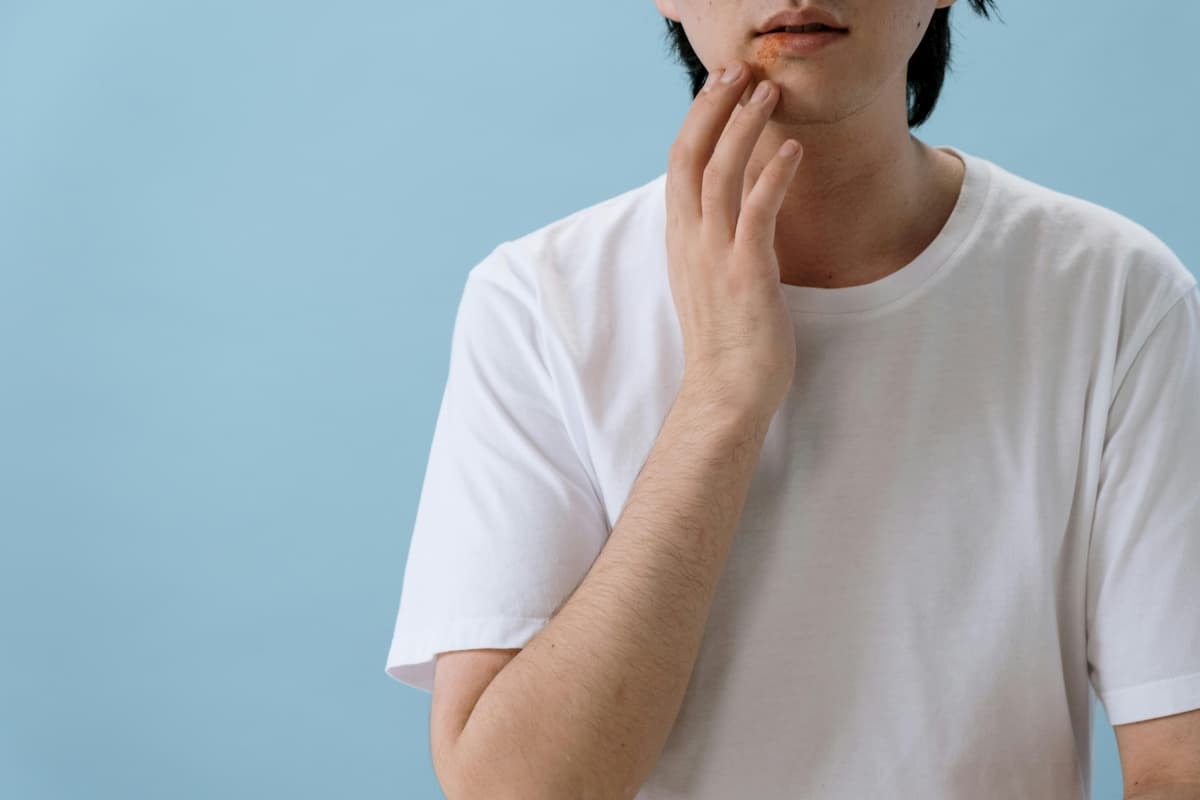Herpes: symtom, behandling, orsaker och när du ska söka läkarråd